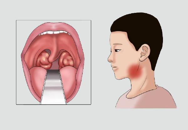 白叟身上的白叟味该怎么消除？